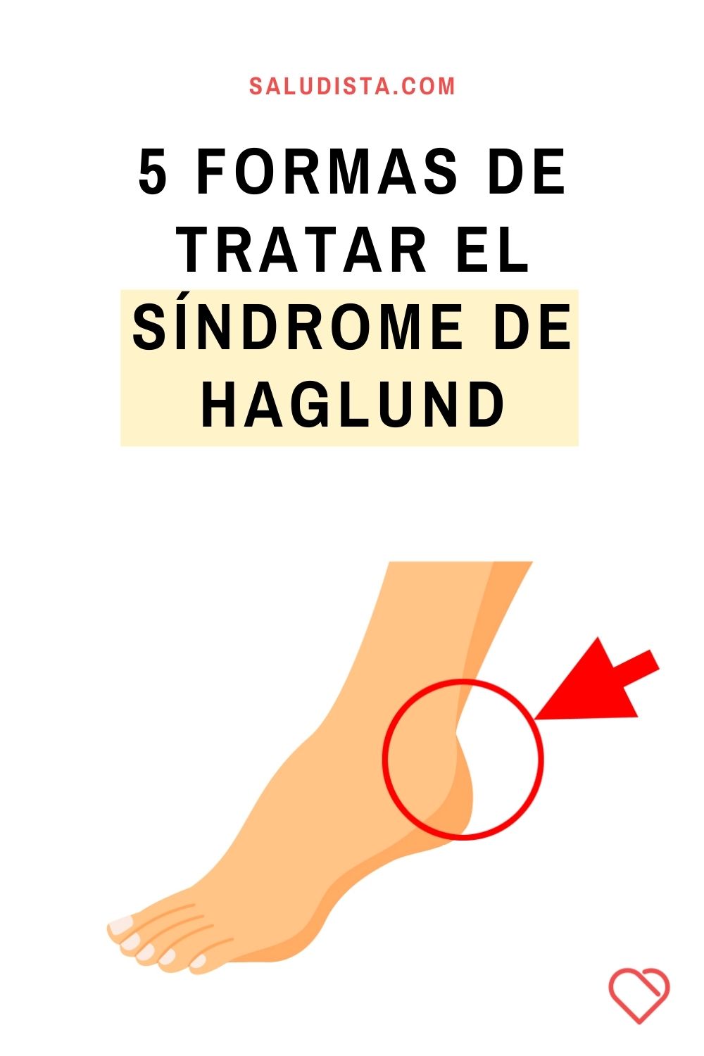 5 formas de tratar el síndrome de Haglund