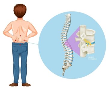 Dolor de espalda: causas y tratamiento