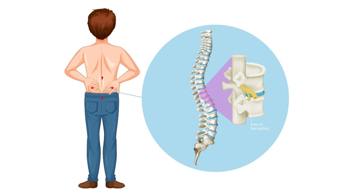 Dolor de espalda: causas y tratamiento