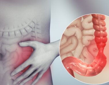 Causas y factores de riesgo del síndrome del intestino irritable (SII)