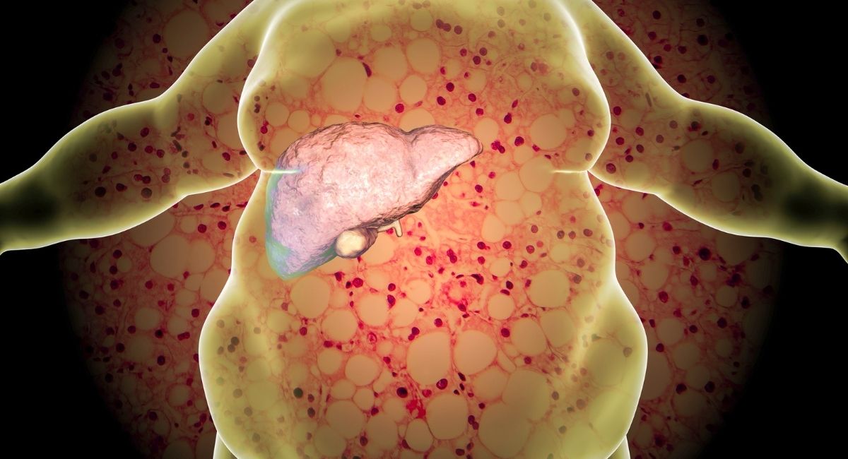 9 Cosas sorprendentes que hacen daño al hígado