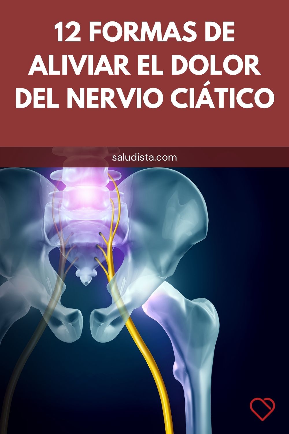 12 Formas de aliviar el dolor del nervio ciático