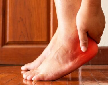 9 Cosas que puedes hacer si tienes fascitis plantar