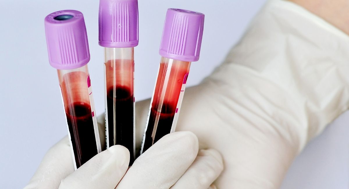 El tipo de sangre no afecta al riesgo de COVID-19