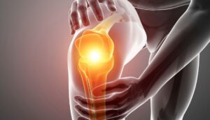 12 Cosas comunes que causan dolor de rodilla