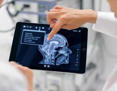 1 de cada 3 tiene problemas neurológicos y psiquiátricos después de la COVID-19