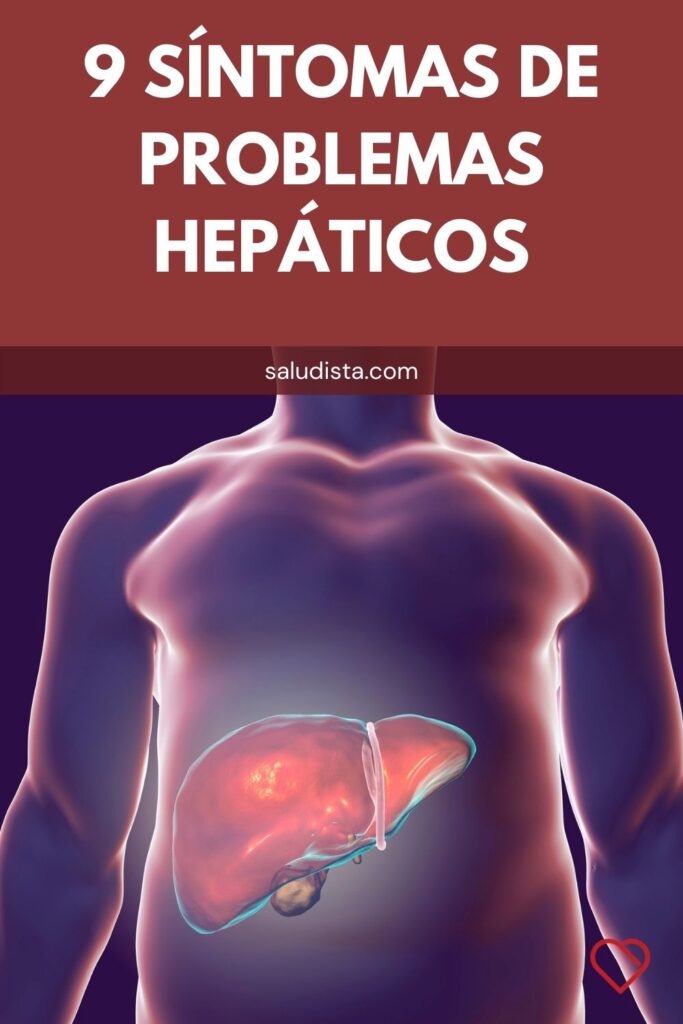 9 Síntomas de problemas hepáticos