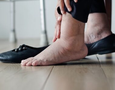 5 razones por las que tienes retencion de liquidos (y cómo evitarlo)