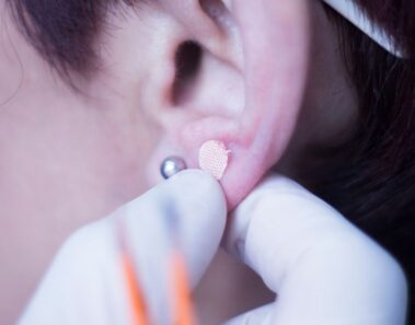 Semillas para auriculoterapia: Lo que hay que saber