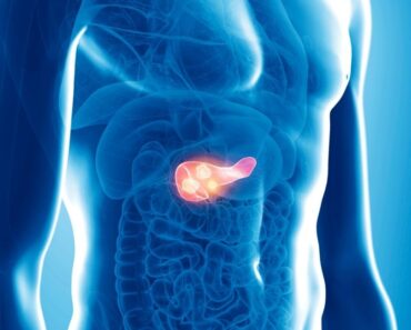 Cáncer de páncreas: Síntomas, causas y tratamiento