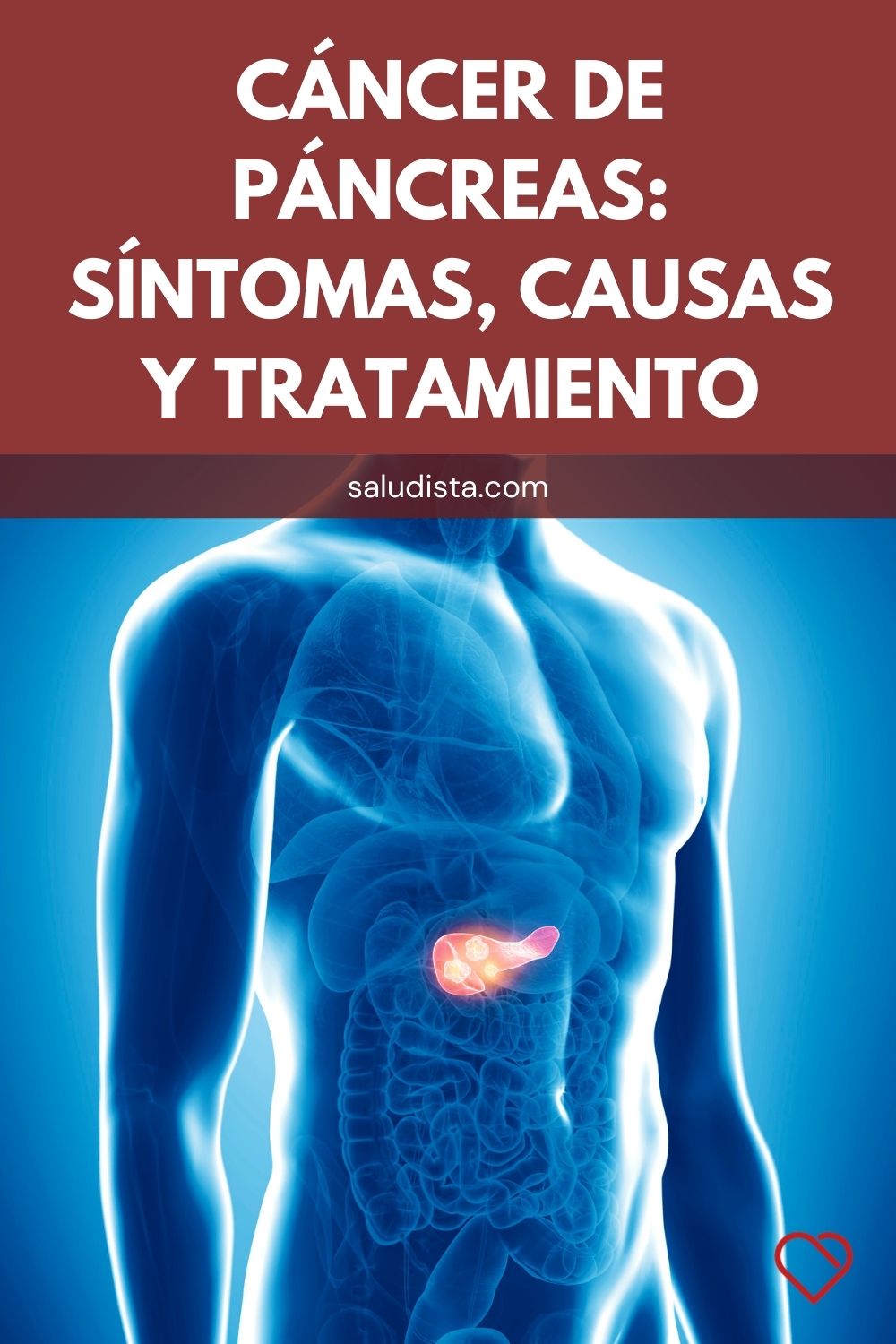 Cáncer de páncreas: Síntomas, causas y tratamiento