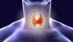 7 cambios de vida que pueden ayudar con los problemas de tiroides
