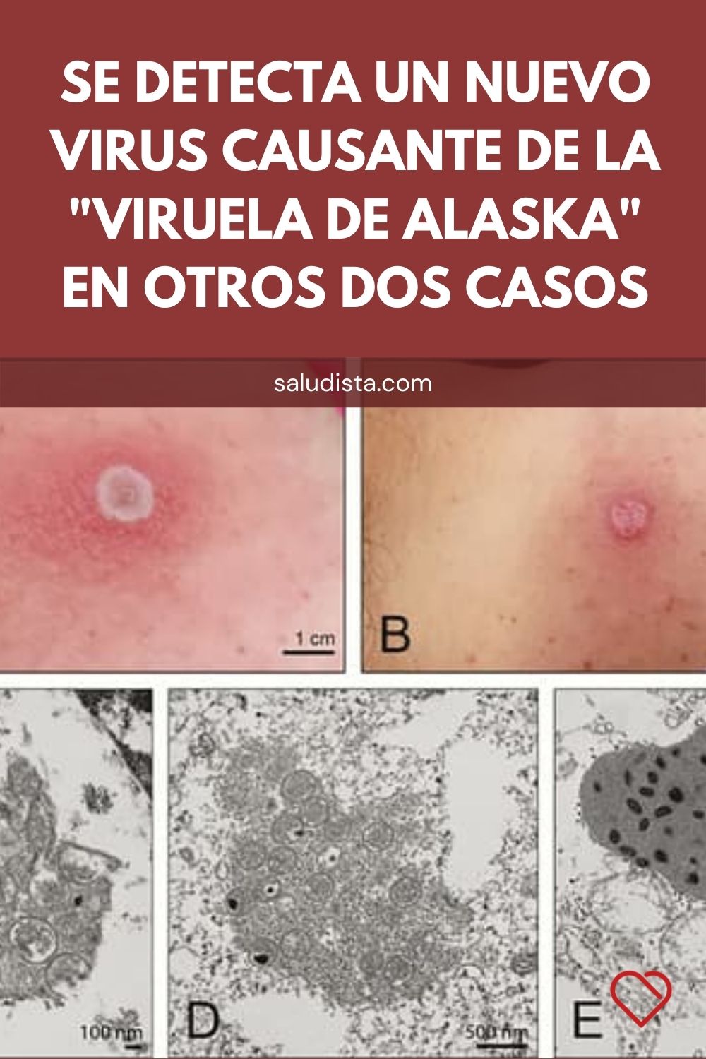 Se detecta un nuevo virus causante de la "viruela de Alaska" en otros dos casos